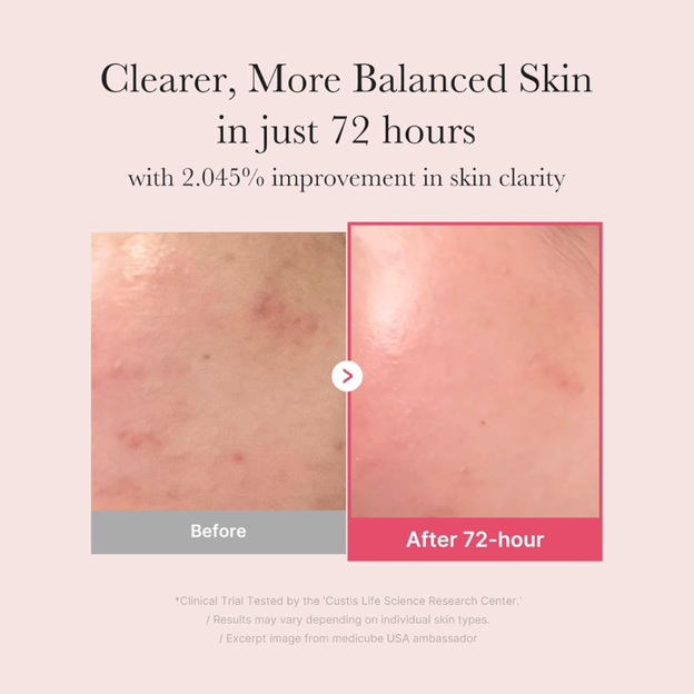 TXA Niacinamide Serum