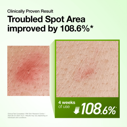 Azelaic Acid 10 Hyaluron Redness Soothing Serum